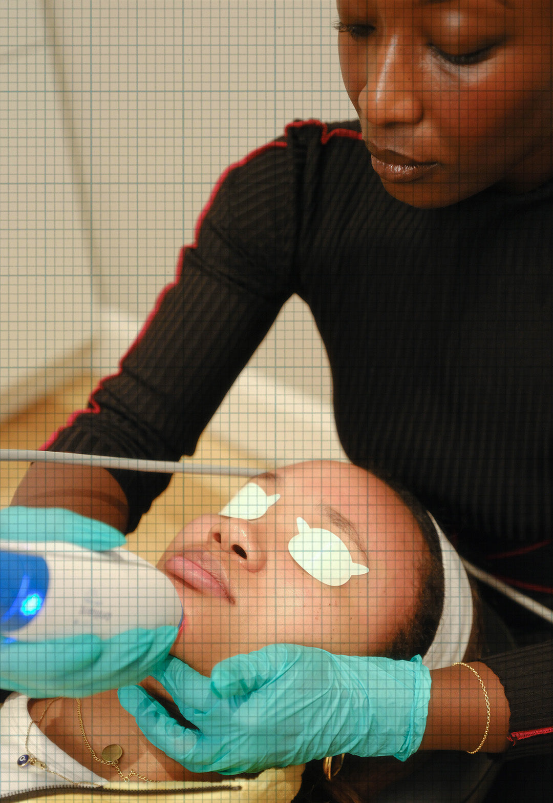 e.book:hyperpigmentation - Chapter 4.1: How Professionals Fade Hyperpigmentation