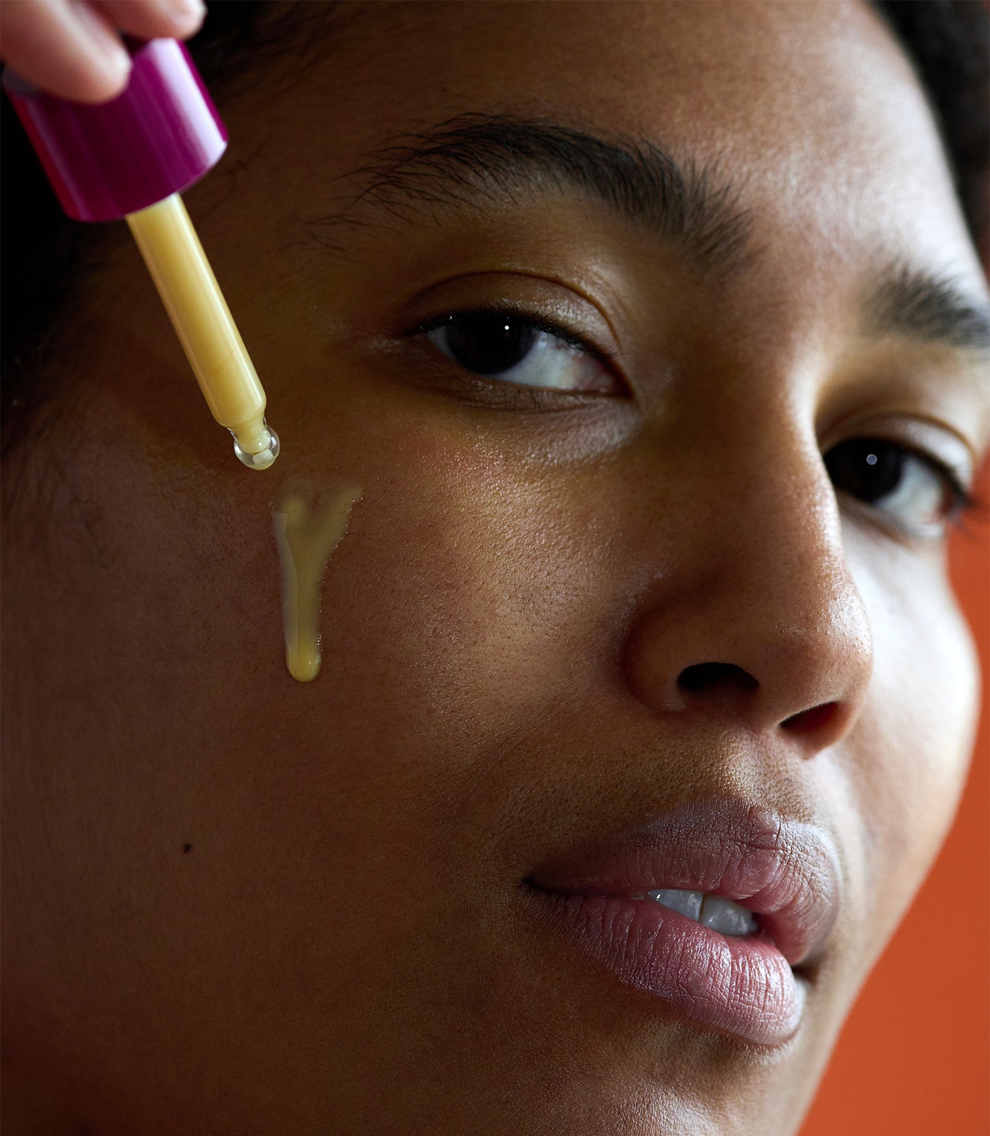 Hyperpigmentation RX