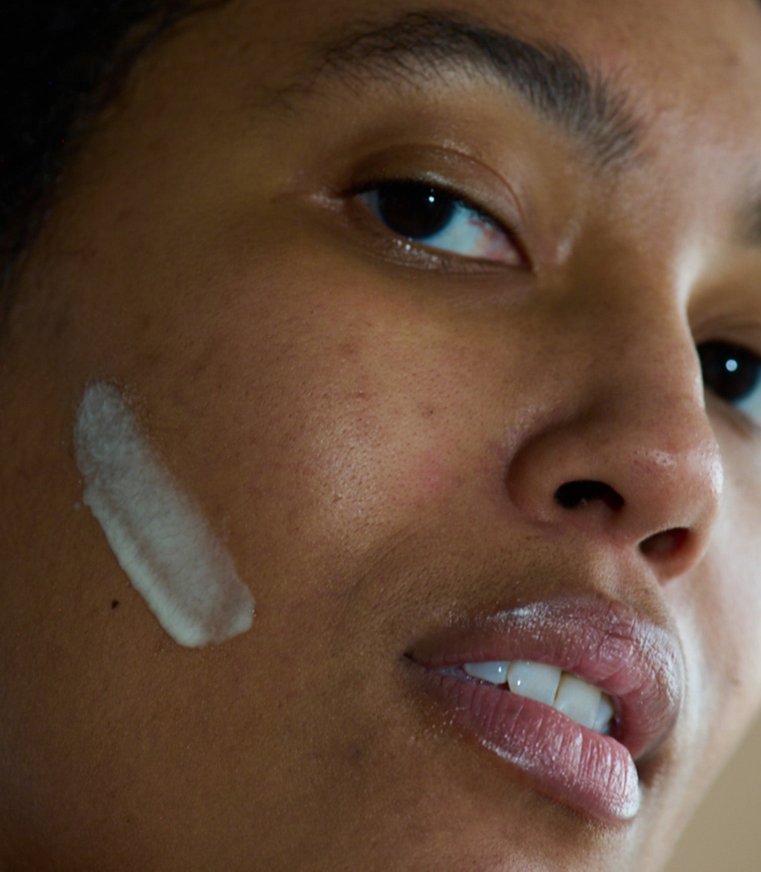 Close-up of a person's face with a white cream applied to the cheek.