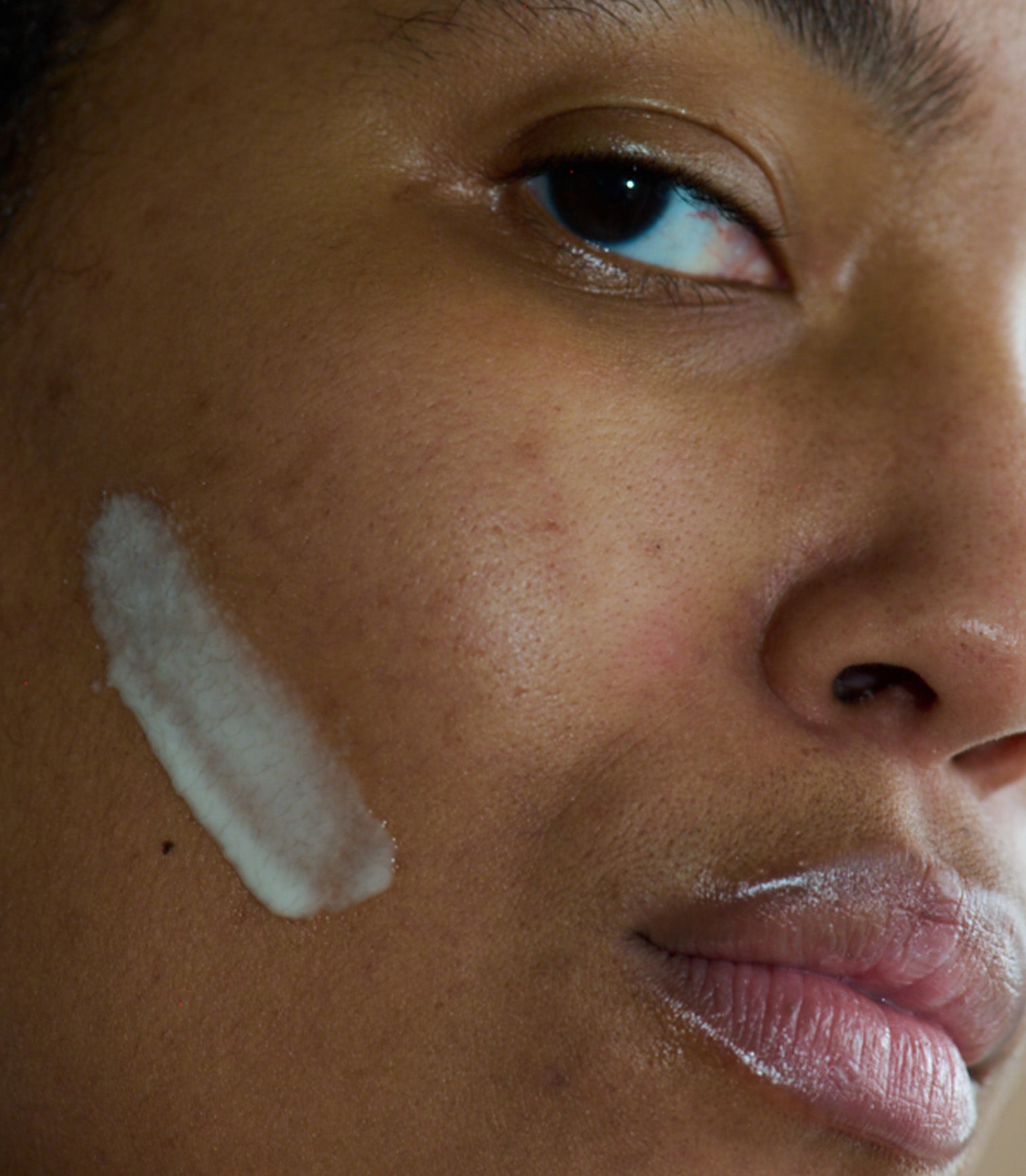 Close-up of a person's face with a white patch on their cheek