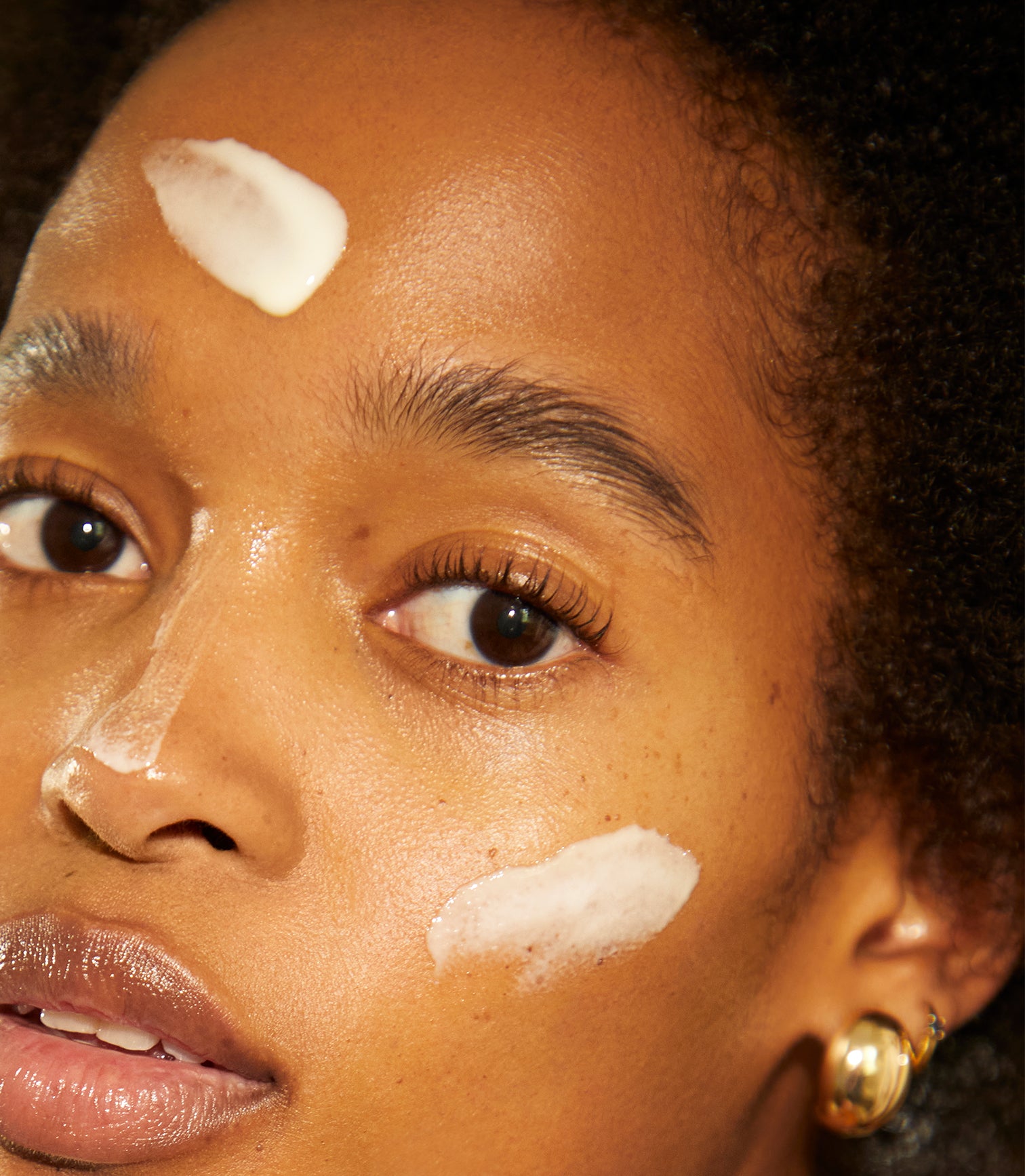 Pregnancy Hyperpigmentation RX